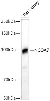 Western blot analysis of Rat kidney using NCOA7 Polyclonal Antibody at 1:1000 dilution.