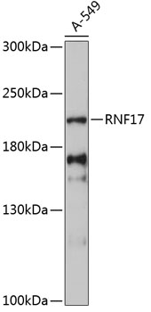 Western blot analysis of extracts of A-549 cells using RNF17 Polyclonal Antibody at 1:3000 dilution.