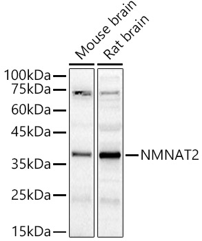 Western blot analysis of various lysates using NMNAT2 Polyclonal Antibody at 1:400 dilution.