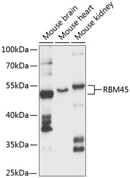 Western blot analysis of extracts of various cell lines using RBM45 Polyclonal Antibody at 1:3000 dilution.