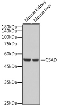 Western blot analysis of extracts of various cell lines using CSAD Polyclonal Antibody at 1:5000 dilution.