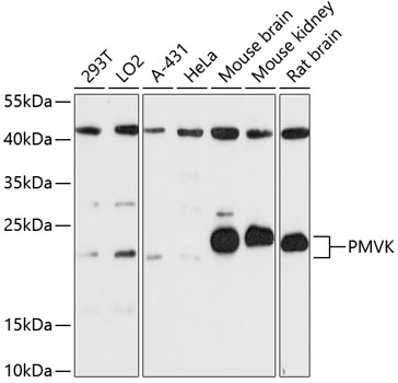 Western blot analysis of extracts of various cell lines using PMVK Polyclonal Antibody at 1:3000 dilution.