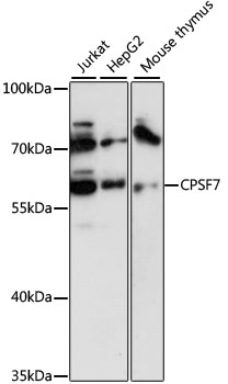 Western blot analysis of extracts of various cell lines using CPSF7 Polyclonal Antibody at 1:3000 dilution.