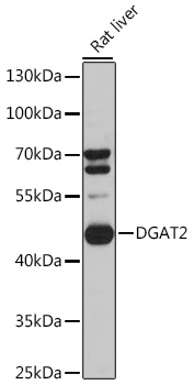 Western blot analysis of extracts of Rat liver cells using DGAT2 Polyclonal Antibody at 1:3000 dilution.