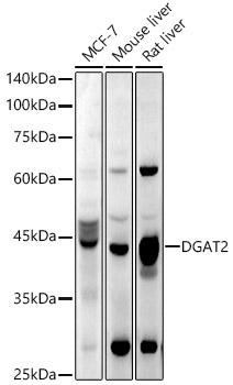 Western blot analysis of extracts of various cell lines using DGAT2 Polyclonal Antibody at 1:1000 dilution.