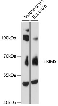 Western blot analysis of extracts of various cell lines using TRIM9 Polyclonal Antibody at 1:3000 dilution.