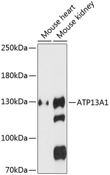 Western blot analysis of extracts of various cell lines using ATP13A1 Polyclonal Antibody at 1:3000 dilution.