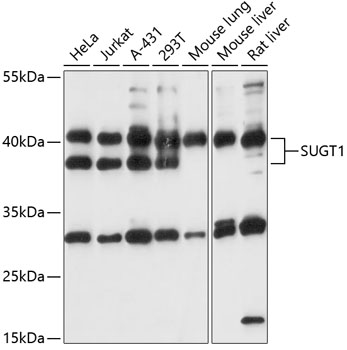 Western blot analysis of extracts of various cell lines using SUGT1 Polyclonal Antibody at 1:1000 dilution.