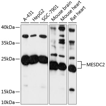 Western blot analysis of extracts of various cell lines using MESDC2 Polyclonal Antibody at 1:3000 dilution.