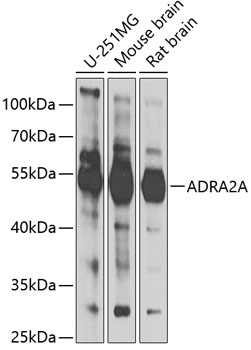 Western blot analysis of extracts of various cell lines using ADRA2A Polyclonal Antibody at 1:1000 dilution.