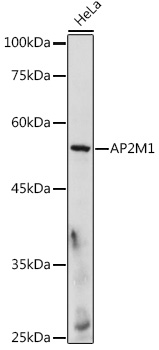 Western blot analysis of extracts of HeLa cells using AP2M1 Polyclonal Antibody at 1:500 dilution.