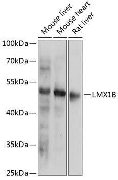 Western blot analysis of extracts of various cell lines using LMX1B Polyclonal Antibody at 1:1000 dilution.