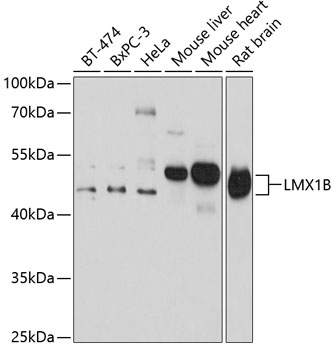 Western blot analysis of extracts of various cell lines using LMX1B Polyclonal Antibody at 1:1000 dilution.