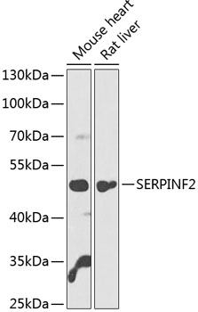 Western blot analysis of extracts of various cell lines using SERPINF2 Polyclonal Antibody at 1:1000 dilution.