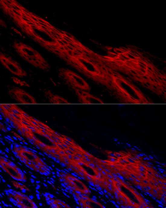 Immunofluorescence analysis of human skin cells using PPL Polyclonal Antibody at dilution of 1:500 (40x lens). Blue: DAPI for nuclear staining.