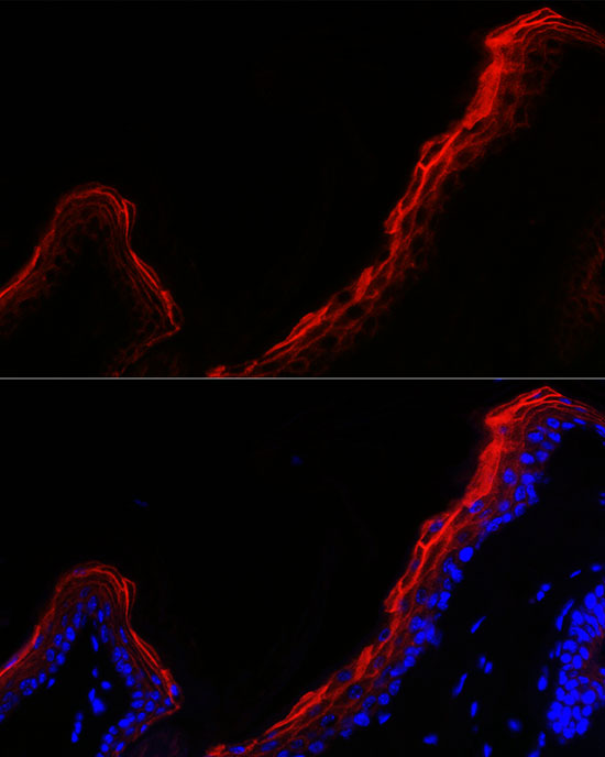 Immunofluorescence analysis of mouse skin cells using PPL Polyclonal Antibody at dilution of 1:500 (40x lens). Blue: DAPI for nuclear staining.