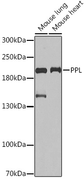 Western blot analysis of extracts of various cell lines using PPL Polyclonal Antibody at1:1000 dilution.