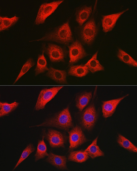 Immunofluorescence analysis of NIH/3T3 cells using [KO Validated] AMPKα2 Polyclonal Antibody at dilution of 1:100 (40x lens). Blue: DAPI for nuclear staining.