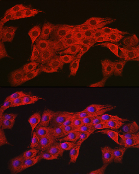 Immunofluorescence analysis of PC-12 cells using [KO Validated] AMPKα2 Polyclonal Antibody at dilution of 1:100 (40x lens). Blue: DAPI for nuclear staining.