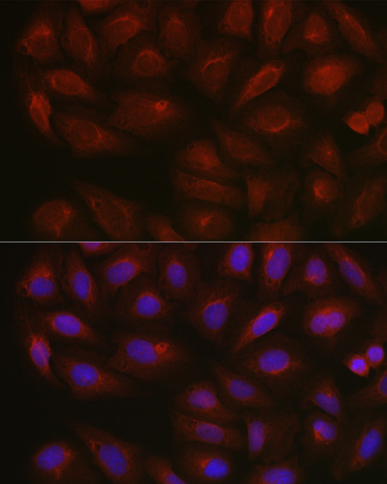 Immunofluorescence analysis of U2OS cells using [KO Validated] AMPKα2 Polyclonal Antibody at dilution of 1:100 (40x lens). Blue: DAPI for nuclear staining.