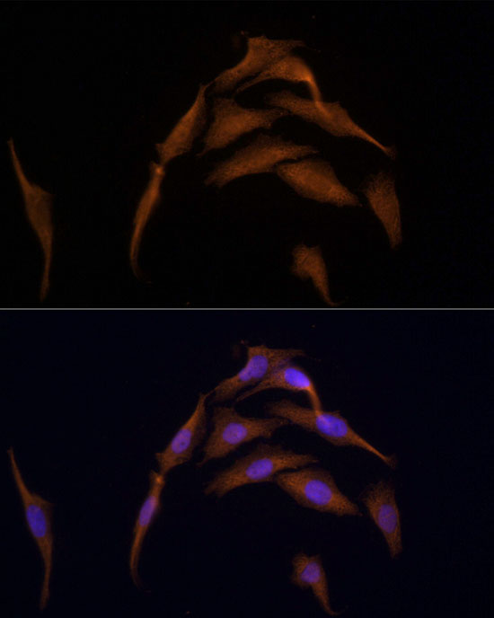 Immunofluorescence analysis of HeLa using AMPKα2 Polyclonal Antibody at dilution of 1:100 (40x lens). Blue: DAPI for nuclear staining.