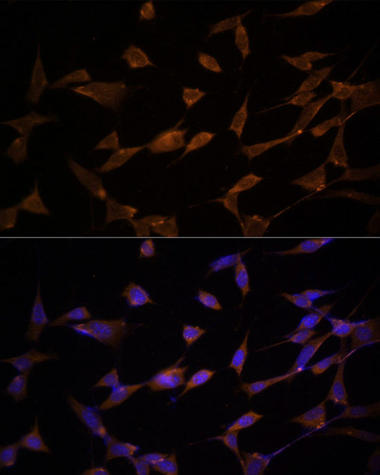 Immunofluorescence analysis of NIH/3T3 using AMPKα2 Polyclonal Antibody at dilution of 1:100 (40x lens). Blue: DAPI for nuclear staining.