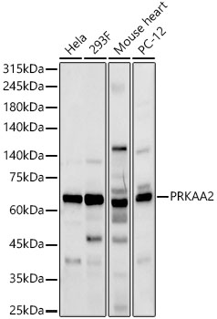 Western blot analysis of various lysates using PRKAA2 Polyclonal Antibody at 1:1000 dilution.