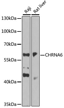 Western blot analysis of extracts of various cell lines using CHRNA6 Polyclonal Antibody at 1:1000 dilution.