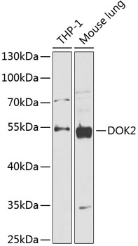 Western blot analysis of extracts of various cell lines using DOK2 Polyclonal Antibody at 1:1000 dilution.