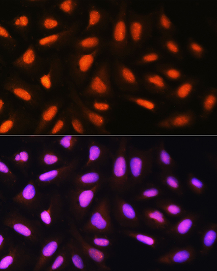 Immunofluorescence analysis of U2OS cells using N4BP1 Polyclonal Antibody at dilution of 1:100. Blue: DAPI for nuclear staining.