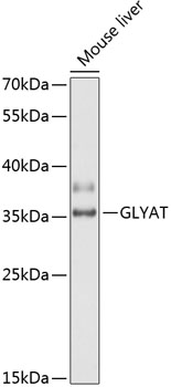 Western blot analysis of extracts of mouse liver using GLYAT Polyclonal Antibody at 1:3000 dilution.