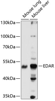 Western blot analysis of extracts of various cell lines using EDAR Polyclonal Antibody at 1:1000 dilution.