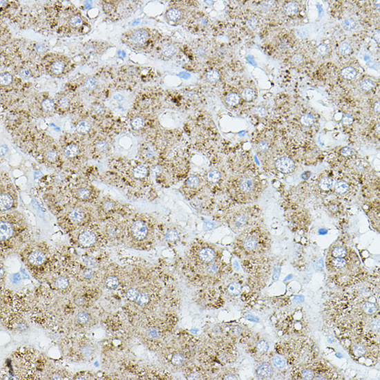 Immunohistochemistry of paraffin-embedded human liver using EIF2AK1 Polyclonal Antibody at dilution of 1:500 (40x lens).Perform high pressure antigen retrieval with 10 mM citrate buffer pH 6.0 before commencing with IHC staining protocol.