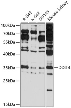 Western blot analysis of extracts of various cell lines using DDIT4 Polyclonal Antibody at 1:1000 dilution.