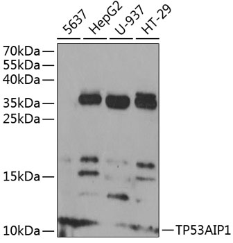 Western blot analysis of extracts of various cell lines using TP53AIP1 Polyclonal Antibody at 1:1000 dilution.