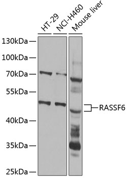 Western blot analysis of extracts of various cell lines using RASSF6 Polyclonal Antibody at 1:1000 dilution.