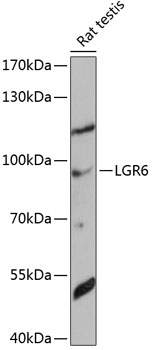 Western blot analysis of extracts of rat testis using LGR6 Polyclonal Antibody at 1:1000 dilution.