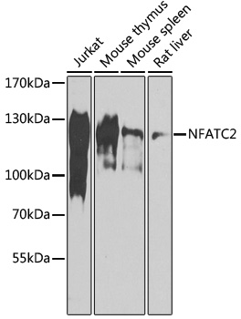 Western blot analysis of extracts of various cell lines using NFATC2 Polyclonal Antibody at 1:1000 dilution.