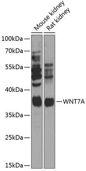 Western blot analysis of extracts of various cell lines using WNT7A Polyclonal Antibody at 1:1000 dilution.