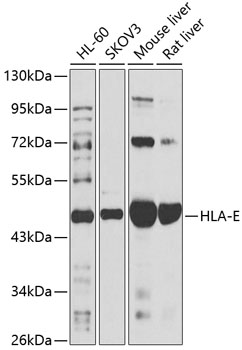 Western blot analysis of extracts of various cell lines using HLA-E Polyclonal Antibody at 1:1000 dilution.