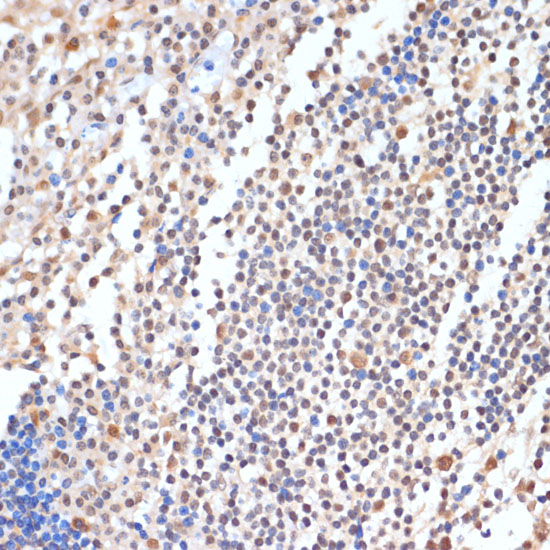 Immunohistochemistry of paraffin-embedded human tonsil using HP1BP3 Polyclonal Antibody at dilution of 1:100 (40x lens).Perform microwave antigen retrieval with 10 mM PBS buffer pH 7.2 before commencing with IHC staining protocol.