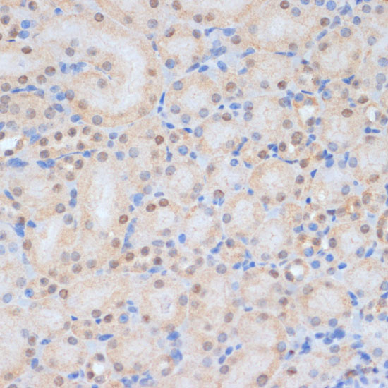 Immunohistochemistry of paraffin-embedded mouse kidney using HP1BP3 Polyclonal Antibody at dilution of 1:100 (40x lens).Perform microwave antigen retrieval with 10 mM PBS buffer pH 7.2 before commencing with IHC staining protocol.