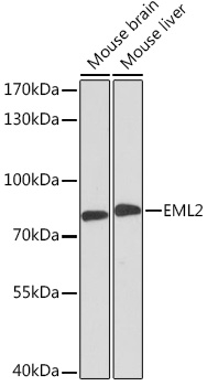 Western blot analysis of extracts of various cell lines using EML2 Polyclonal Antibody at1:3000 dilution.