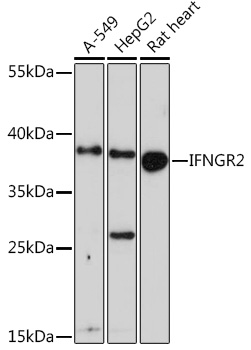 Western blot analysis of extracts of various cell lines using IFNGR2 Polyclonal Antibody at1:1000 dilution.
