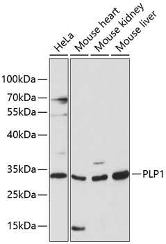 Western blot analysis of extracts of various cell lines using PLP1 Polyclonal Antibody at 1:3000 dilution.