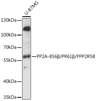 Western blot analysis of extracts of U-87MG cells using PP2A-B56β/PR61β/PP2A-B56β/PR61β/PPP2R5B Polyclonal Antibody at 1:1000 dilution.