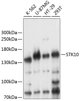 Western blot analysis of extracts of various cell lines using STK10 Polyclonal Antibody at 1:3000 dilution.