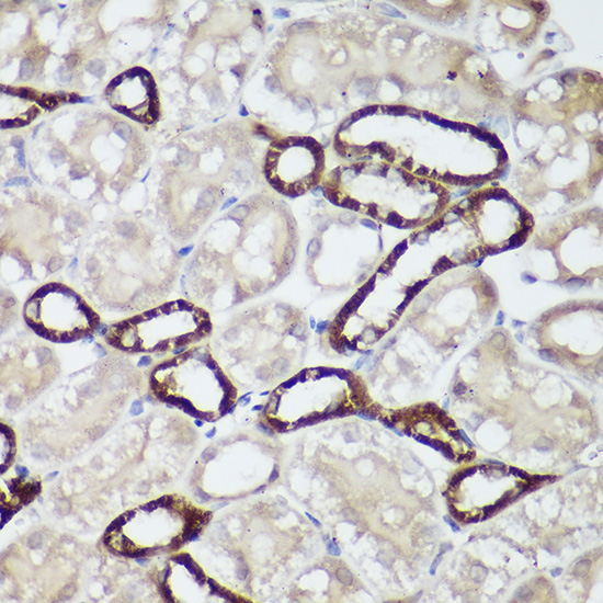 Immunohistochemistry of paraffin-embedded mouse kidney using CASR Polyclonal Antibody at dilution of 1:50 (40x lens).Perform high pressure antigen retrieval with 10 mM citrate buffer pH 6.0 before commencing with IHC staining protocol.