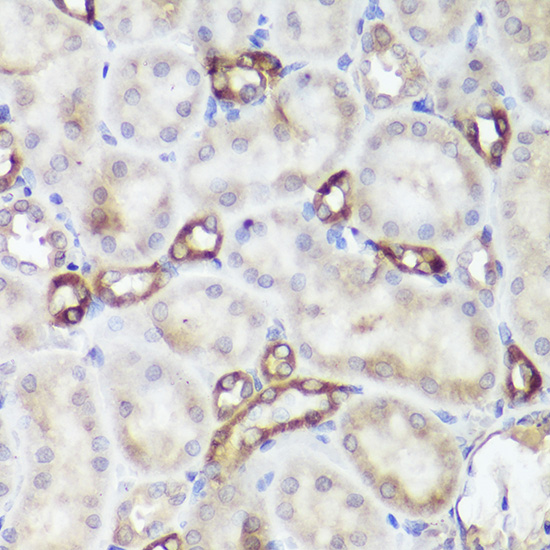 Immunohistochemistry of paraffin-embedded rat kidney using CASR Polyclonal Antibody at dilution of 1:50 (40x lens).Perform high pressure antigen retrieval with 10 mM citrate buffer pH 6.0 before commencing with IHC staining protocol.