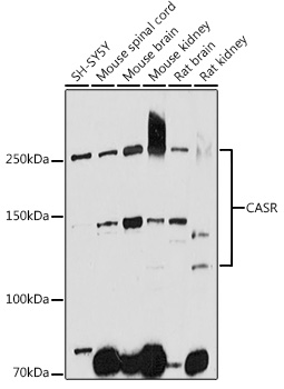 Western blot analysis of extracts of various cell lines using CASR Polyclonal Antibody at 1:1000 dilution.